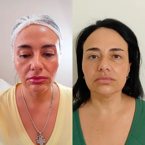 AnyConv.com__PACIENTE-3-FACE